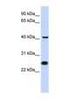 CDC25C Antibody - CDC25C antibody Western blot of Jurkat Cell lysate. Antibody concentration 1 ug/ml. This image was taken for the unconjugated form of this product. Other forms have not been tested.