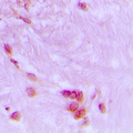 CDC27 Antibody - Immunohistochemical analysis of CDC27 staining in human brain formalin fixed paraffin embedded tissue section. The section was pre-treated using heat mediated antigen retrieval with sodium citrate buffer (pH 6.0). The section was then incubated with the antibody at room temperature and detected using an HRP conjugated compact polymer system. DAB was used as the chromogen. The section was then counterstained with hematoxylin and mounted with DPX.