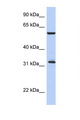 CDC34 Antibody - CDC34 antibody Western blot of Fetal Thymus lysate. Antibody concentration 1 ug/ml. This image was taken for the unconjugated form of this product. Other forms have not been tested.