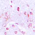 CDC37 Antibody - Immunohistochemical analysis of CDC37 staining in human brain formalin fixed paraffin embedded tissue section. The section was pre-treated using heat mediated antigen retrieval with sodium citrate buffer (pH 6.0). The section was then incubated with the antibody at room temperature and detected using an HRP conjugated compact polymer system. DAB was used as the chromogen. The section was then counterstained with hematoxylin and mounted with DPX.