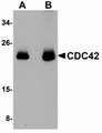 CDC42 Antibody - Western blot of CDC42 in human brain tissue lysate with CDC42 antibody at (A) 0.5 and (B) 1 ug/ml.