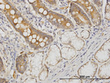 CDC42BPB / MRCKB Antibody - Immunoperoxidase of monoclonal antibody to CDC42BPB on formalin-fixed paraffin-embedded human small Intestine. [antibody concentration 3 ug/ml]