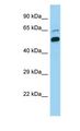 CDC73 / Parafibromin Antibody - CDC73 / Parafibromin antibody Western Blot of Human HeLa Cell. Antibody dilution: 1 ug/ml.  This image was taken for the unconjugated form of this product. Other forms have not been tested.