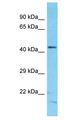 CDCA1 / NUF2 Antibody - CDCA1 / NUF2 antibody Western Blot of RPMI-8226. Antibody dilution: 1 ug/ml.  This image was taken for the unconjugated form of this product. Other forms have not been tested.