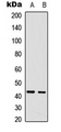 CDCA7 Antibody - Western blot analysis of CDCA7 expression in A431 (A); U2OS (B) whole cell lysates.