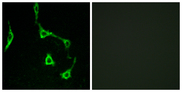CDH10 / Cadherin 10 Antibody - Immunofluorescence analysis of LOVO cells, using CDH10 Antibody. The picture on the right is blocked with the synthesized peptide.