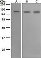 CDH10 / Cadherin 10 Antibody - Western blot analysis on (A) fetal brain, (B) U87-MG, and (C) fetal lung lysates using anti-Cadherin-10 antibody.