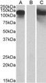 CDH11 / Cadherin 11 Antibody - HEK293 lysate (10ug protein in RIPA buffer) overexpressing Human CDH11 with C-terminal MYC tag probed with (1ug/ml) in Lane A and probed with anti-MYC Tag (1/1000) in lane C. Mock-transfected HEK293 probed (1mg/ml) in Lane B. Primary