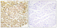 CDH13 / Cadherin 13 Antibody - Immunohistochemistry analysis of paraffin-embedded human heart tissue, using CDH13 Antibody. The picture on the right is blocked with the synthesized peptide.
