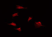 CDH17 / Cadherin 17 Antibody - Staining HeLa cells by IF/ICC. The samples were fixed with PFA and permeabilized in 0.1% Triton X-100, then blocked in 10% serum for 45 min at 25°C. The primary antibody was diluted at 1:200 and incubated with the sample for 1 hour at 37°C. An Alexa Fluor 594 conjugated goat anti-rabbit IgG (H+L) Ab, diluted at 1/600, was used as the secondary antibody.