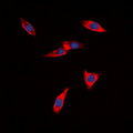 CDH22 / Cadherin 22 Antibody - Immunofluorescent analysis of PB Cadherin staining in HeLa cells. Formalin-fixed cells were permeabilized with 0.1% Triton X-100 in TBS for 5-10 minutes and blocked with 3% BSA-PBS for 30 minutes at room temperature. Cells were probed with the primary antibody in 3% BSA-PBS and incubated overnight at 4 deg C in a humidified chamber. Cells were washed with PBST and incubated with a DyLight 594-conjugated secondary antibody (red) in PBS at room temperature in the dark. DAPI was used to stain the cell nuclei (blue).
