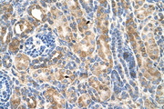 CDH3 / P-Cadherin Antibody - CDH3 / P Cadherin antibody ARP45170_T100-NP_001784-CDH3(cadherin 3, type 1, P-cadherin (placental)) Antibody IHC of formalin-fixed, paraffin-embedded human Kidney. Positive label: Epithelial cells of renal tubule indicated with arrows. Antibody concentration 4-8 ug/ml. Magnification 400X.  This image was taken for the unconjugated form of this product. Other forms have not been tested.