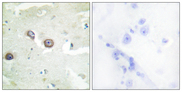 CDH4 / R Cadherin Antibody - Immunohistochemistry analysis of paraffin-embedded human brain tissue, using CDH4 Antibody. The picture on the right is blocked with the synthesized peptide.