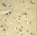 CDIPT Antibody - Formalin-fixed and paraffin-embedded human brain tissue reacted with CDIPT Antibody , which was peroxidase-conjugated to the secondary antibody, followed by DAB staining. This data demonstrates the use of this antibody for immunohistochemistry; clinical relevance has not been evaluated.