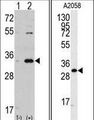 CDK1 / CDC2 Antibody - Western blot of CDC2 (arrow) using rabbit polyclonal CDC2 Antibody. 293 cell lysates (2 ug/lane) either nontransfected (Lane 1) or transiently transfected with the CDC2 gene (Lane 2) (Origene Technologies).