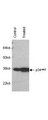 CDK1 / CDC2 Antibody - Mab anti-Human p34Cdc2 antibody was used to detect human p34Cdc2by Western blot of untreated (control) and drug treated (10 M genistein) lysates of MCF-7 cells. Very strong detection occurs using a 1:1000 dilution. Personnel Communication, Xiao He Yang, University of Oklahoma Health Sciences Center.