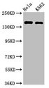 CDK12 / CRKRS Antibody - Positive Western Blot detected in Hela whole cell lysate, K562 whole cell lysate. All lanes: CDK12 antibody at 2 µg/ml Secondary Goat polyclonal to rabbit IgG at 1/50000 dilution. Predicted band size: 165, 164, 142 KDa. Observed band size: 165 KDa