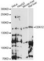 CDK12 / CRKRS Antibody - Western blot analysis of extracts of various cell lines, using CDK12 antibody at 1:1000 dilution. The secondary antibody used was an HRP Goat Anti-Rabbit IgG (H+L) at 1:10000 dilution. Lysates were loaded 25ug per lane and 3% nonfat dry milk in TBST was used for blocking. An ECL Kit was used for detection and the exposure time was 90s.