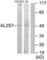 CDK15 / ALS2CR7 Antibody - Western blot analysis of lysates from Jurkat and HUVEC cells, using AL2S7 Antibody. The lane on the right is blocked with the synthesized peptide.