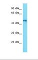 CDK15 / ALS2CR7 Antibody - Western blot of Mouse Brain. Cdk15 antibody dilution 1.0 ug/ml.  This image was taken for the unconjugated form of this product. Other forms have not been tested.