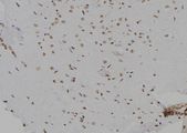 CDK20 / CCRK Antibody - 1:100 staining mouse brain tissue by IHC-P. The sample was formaldehyde fixed and a heat mediated antigen retrieval step in citrate buffer was performed. The sample was then blocked and incubated with the antibody for 1.5 hours at 22°C. An HRP conjugated goat anti-rabbit antibody was used as the secondary.