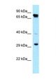 CDK4 Antibody - CDK4 antibody Western blot of HepG2 Cell lysate. Antibody concentration 1 ug/ml.  This image was taken for the unconjugated form of this product. Other forms have not been tested.
