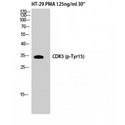 CDK5 Antibody - Western blot of Phospho-Cdk5 (Y15) antibody