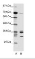 CDK5 Antibody - A: Marker, B: HepG2 Cell Lysate.  This image was taken for the unconjugated form of this product. Other forms have not been tested.
