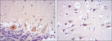 CDK5 Antibody - IHC of paraffin-embedded cerebellum tissues (left) and brain tissues (right) using CDK5 mouse monoclonal antibody with DAB staining.