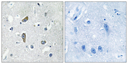 CDK5RAP2 Antibody - Immunohistochemistry analysis of paraffin-embedded human brain, using CDK5RAP2 Antibody. The picture on the right is blocked with the synthesized peptide.