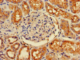 CDK5RAP2 Antibody - Immunohistochemistry of paraffin-embedded human kidney tissue at dilution of 1:100