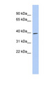 CDK7 Antibody - CDK7 antibody Western blot of THP-1 cell lysate. This image was taken for the unconjugated form of this product. Other forms have not been tested.