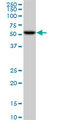 CDK8 Antibody - CDK8 monoclonal antibody (M01), clone 6H5. Western Blot analysis of CDK8 expression in Jurkat.