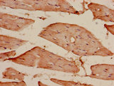 CDKAL1 Antibody - Immunohistochemistry of paraffin-embedded human skeletal muscle tissue using CDKAL1 Antibody at dilution of 1:100
