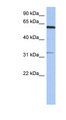 CDKL2 Antibody - CDKL2 antibody Western blot of SH-SYSY lysate. This image was taken for the unconjugated form of this product. Other forms have not been tested.