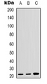 CDKN1A / WAF1 / p21 Antibody - Western blot analysis of p21 expression in MCF7 (A); HUVEC (B); Raw264.7 (C) whole cell lysates.