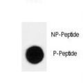 CDKN1B / p27 Kip1 Antibody - Dot blot of anti-Phospho-p27Kip1-T198 Antibody on nitrocellulose membrane. 50ng of Phospho-peptide or Non Phospho-peptide per dot were adsorbed. Antibody working concentrations are 0.5ug per ml.