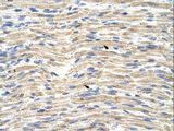 CDKN2AIP Antibody - CDKN2AIP antibody ARP40869_T100-NP_060102-CARF Antibody was used in IHC to stain formalin-fixed, paraffin-embedded human muscle.  This image was taken for the unconjugated form of this product. Other forms have not been tested.