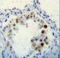 CDKN2B / p15 INK4b Antibody - CDKN2B Antibody immunohistochemistry of formalin-fixed and paraffin-embedded human lung tissue followed by peroxidase-conjugated secondary antibody and DAB staining.