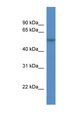 CDR2L Antibody - CDR2L antibody Western blot of OVCAR-3 cell lysate. This image was taken for the unconjugated form of this product. Other forms have not been tested.