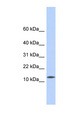 CDRT4 Antibody - CDRT4 antibody Western blot of Fetal Heart lysate. This image was taken for the unconjugated form of this product. Other forms have not been tested.