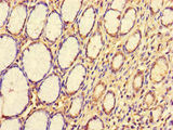 CDS1 Antibody - Immunohistochemistry of paraffin-embedded human stomach tissue at dilution of 1:100