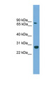 CDX1 Antibody - CDX1 antibody Western blot of Mouse Muscle lysate. This image was taken for the unconjugated form of this product. Other forms have not been tested.