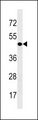 CDY1 Antibody - CDY1 Antibody western blot of A549 cell line lysates (35 ug/lane). The CDY1 antibody detected the CDY1 protein (arrow).
