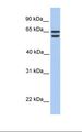 CDYL2 Antibody - 721_B cell lysate. Antibody concentration: 1.0 ug/ml. Gel concentration: 12%.  This image was taken for the unconjugated form of this product. Other forms have not been tested.