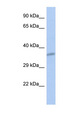 CEACAM19 Antibody - CEACAM19 antibody Western blot of SH-SYSY lysate. This image was taken for the unconjugated form of this product. Other forms have not been tested.