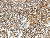 CEACAM21 Antibody - Immunohistochemistry of paraffin-embedded Human tonsil using CEACAM21 Polyclonal Antibody at dilution of 1:60.