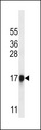 CELA1 / Pancreatic Elastase 1 Antibody - CELA1 Antibody western blot of A2058 cell line lysates (35 ug/lane). The CELA1 antibody detected the CELA1 protein (arrow).