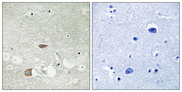 CELSR2 Antibody - Immunohistochemistry analysis of paraffin-embedded human brain tissue, using CELSR2 Antibody. The picture on the right is blocked with the synthesized peptide.