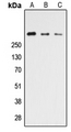 CELSR3 Antibody - Western blot analysis of CELSR3 expression in HEK293T (A); NS-1 (B); PC12 (C) whole cell lysates.